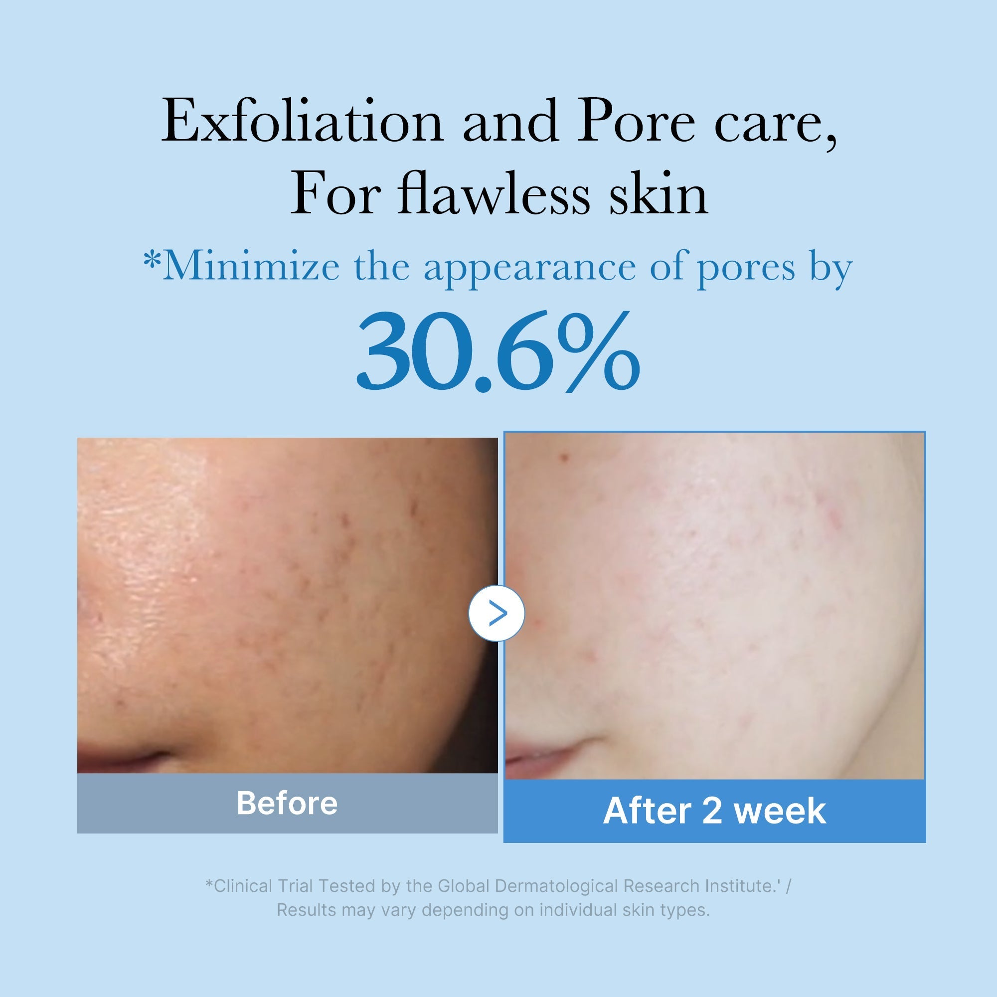 Zero Pore Toner - Fresh Care Daily