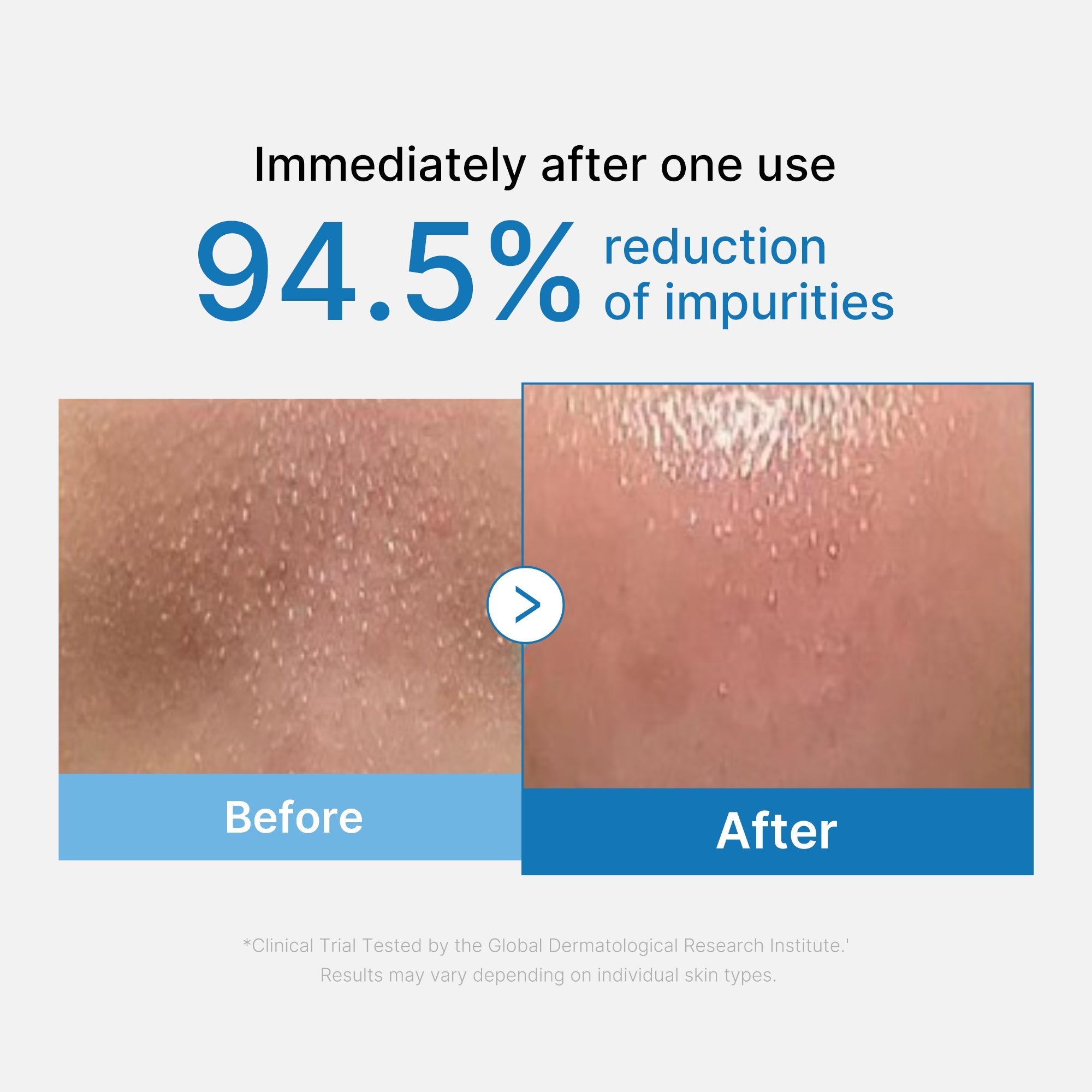 Zero Pore Blackhead Deep Cleansing Oil - Fresh Skin Pick