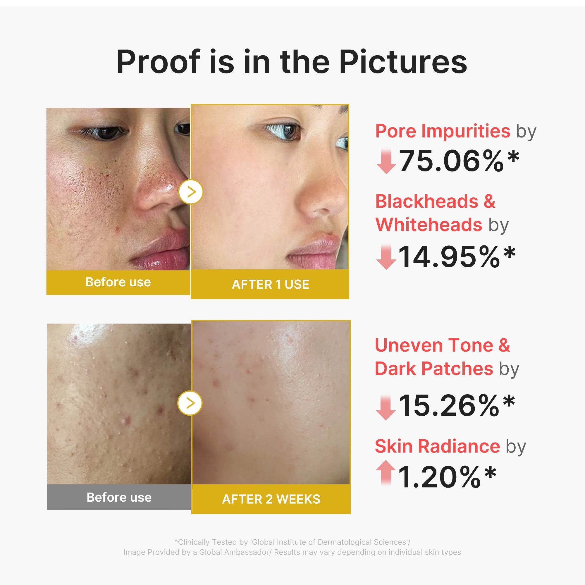 Kojic Acid Turmeric Peel Shot - Routine Made Easy