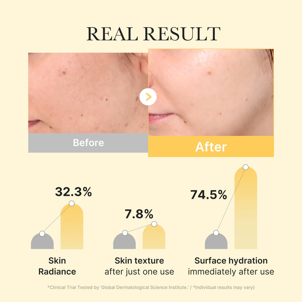 Kojic Acid Turmeric Gold Jelly Gel Mask - Daily Refresh