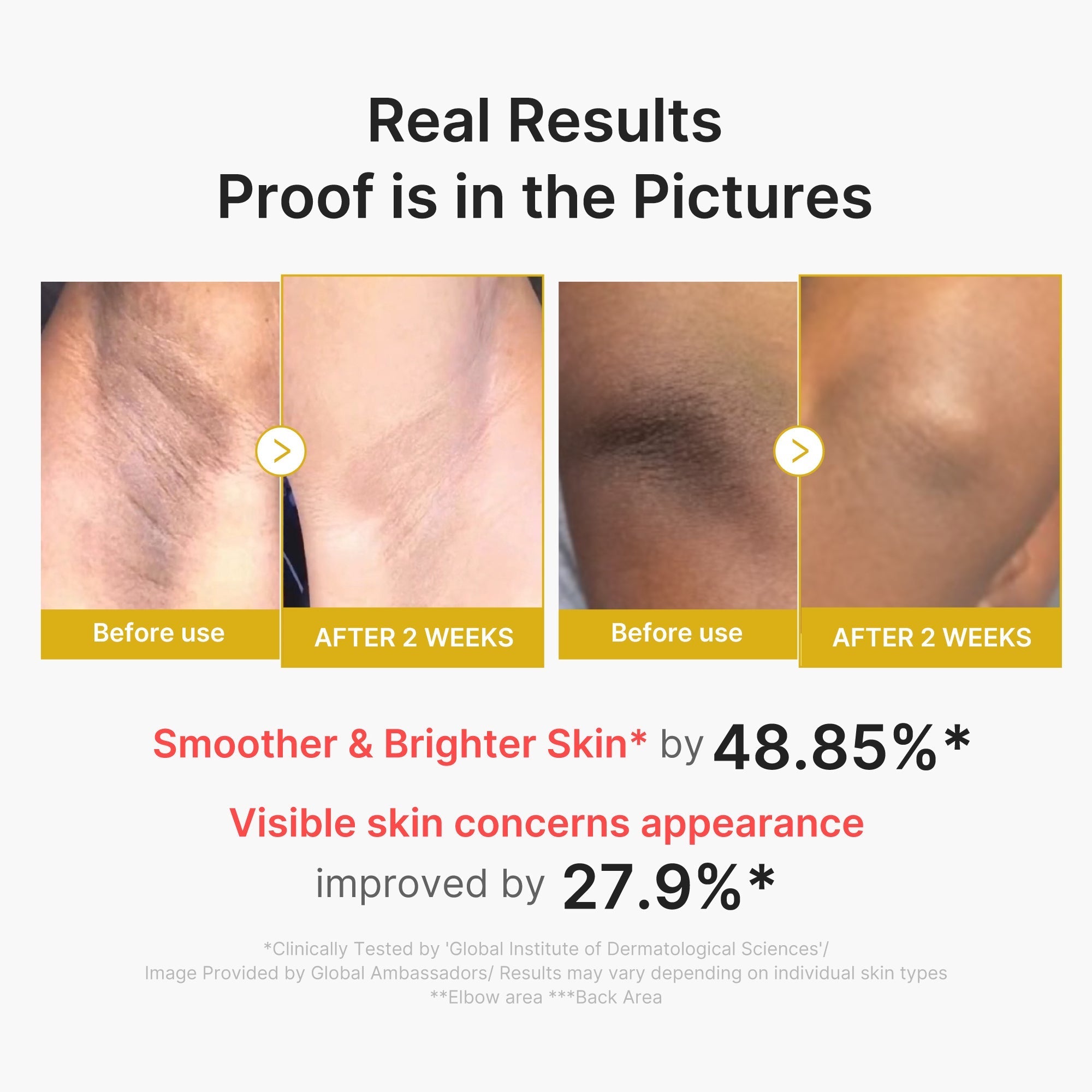 Kojic Acid Turmeric Body Peel Shot - Glow Care Made Easy