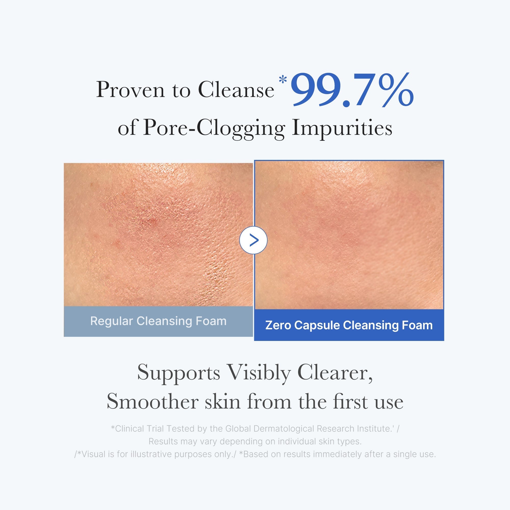 Zero Pore Capsule Cleansing Foam - Fresh-Looking Skin