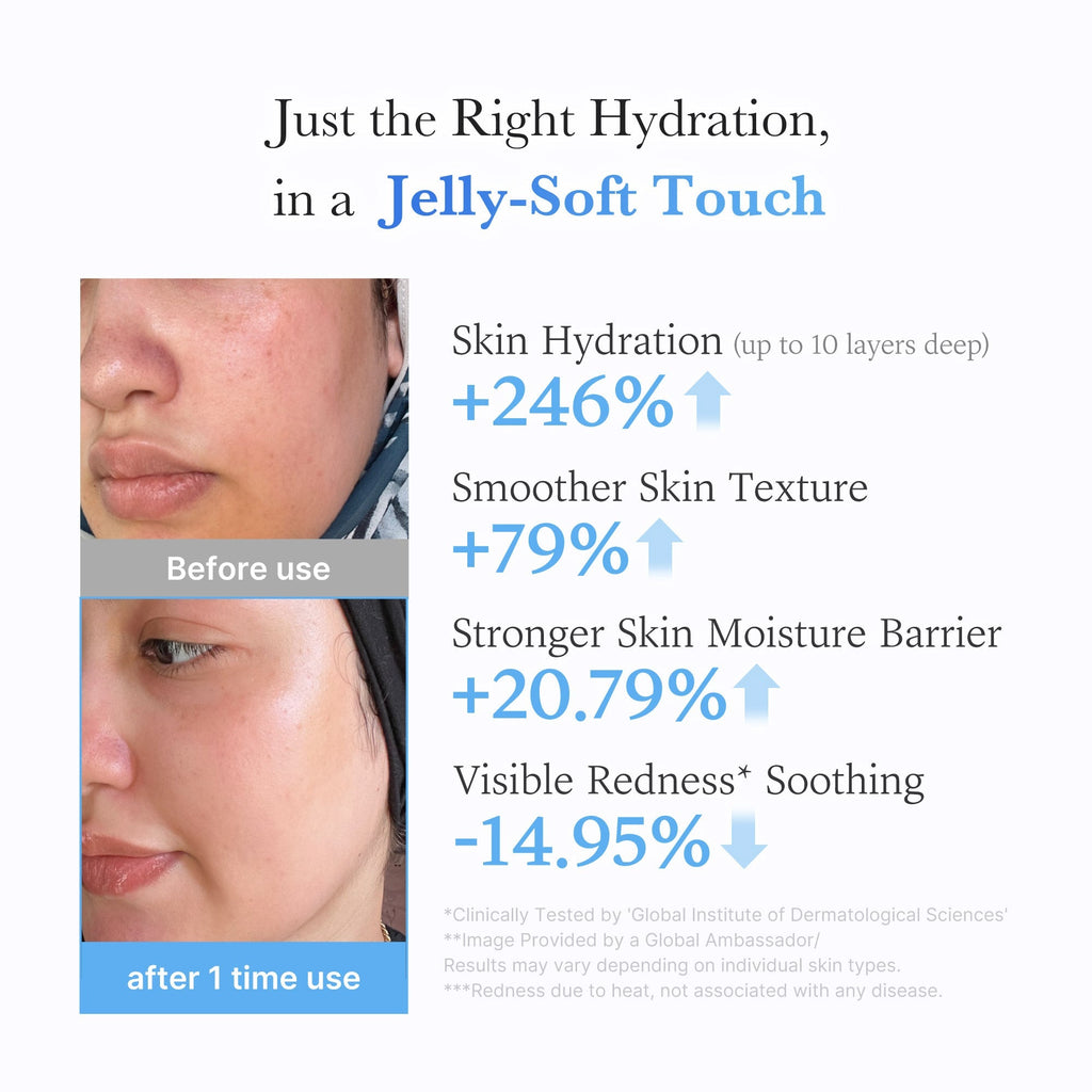 Hyaluronic Ceramide Moisturizing Jelly Cream - Hydration Made Easy