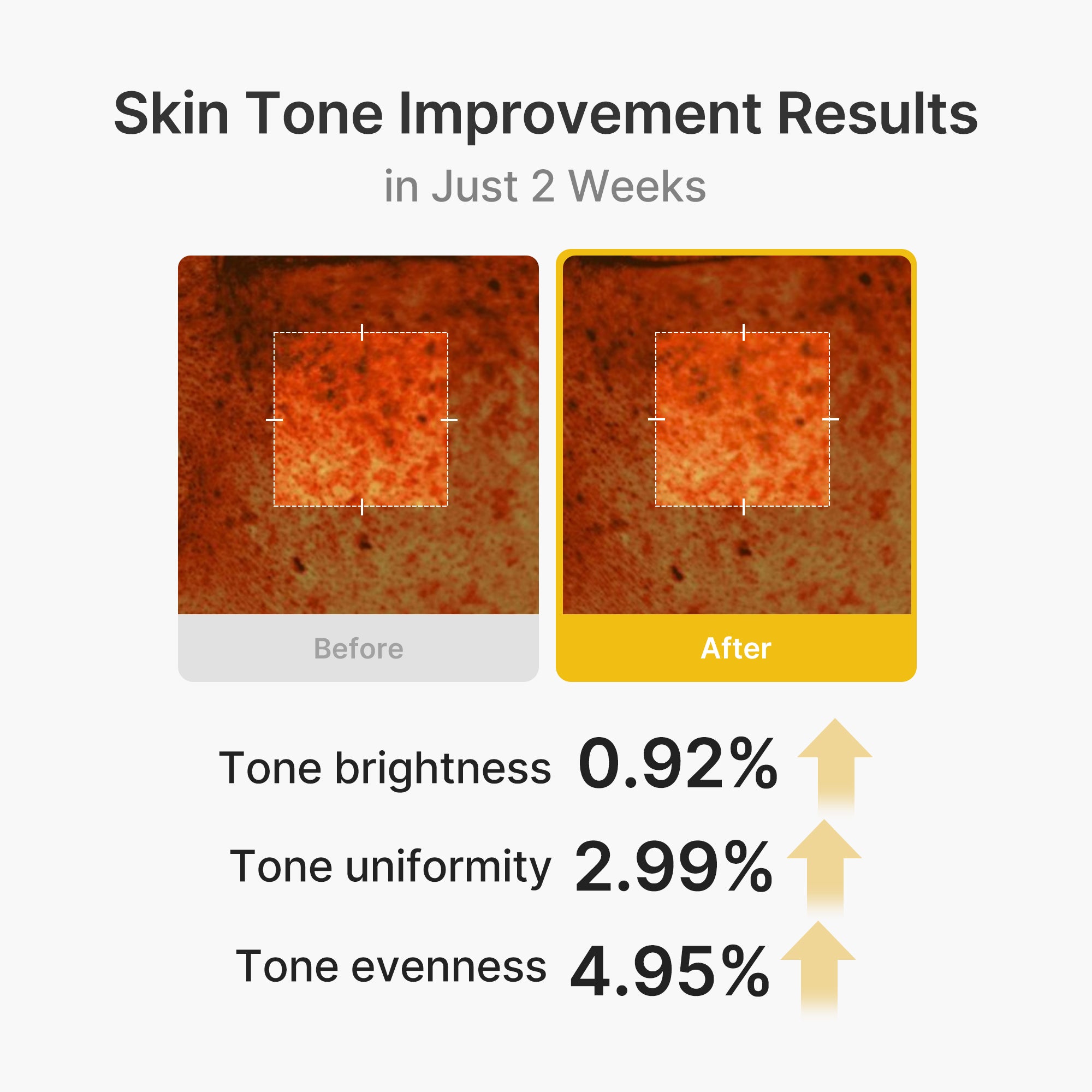 Kojic Acid Turmeric Vita Capsule Cream - Glow Favorites