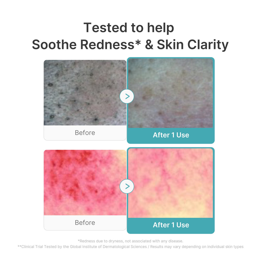 Azelaic Acid Capsule Foam Cleanser - Made for Your Routine