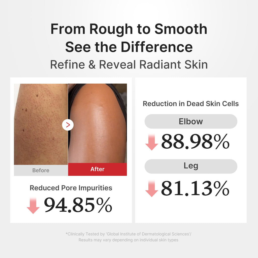 Hypochlorous Acid Rice Body Peel Shot - Glow for Real Life