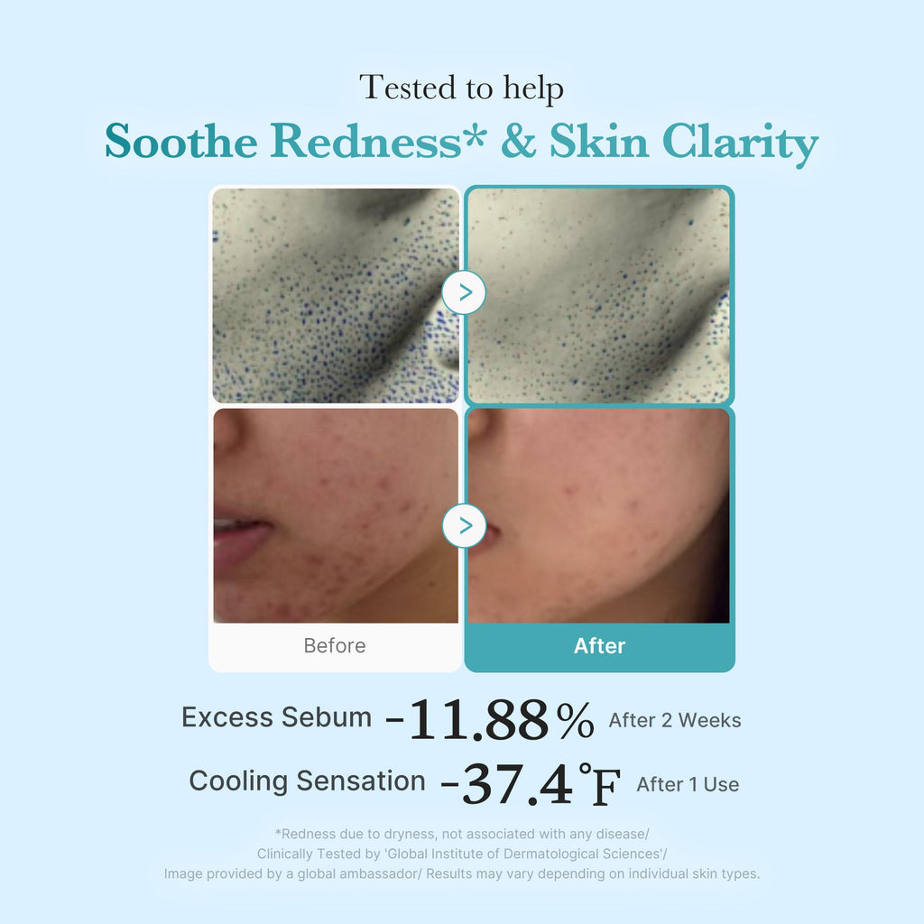 Azelaic Acid Niacinamide Clarifying Toner - Daily Care Favorites