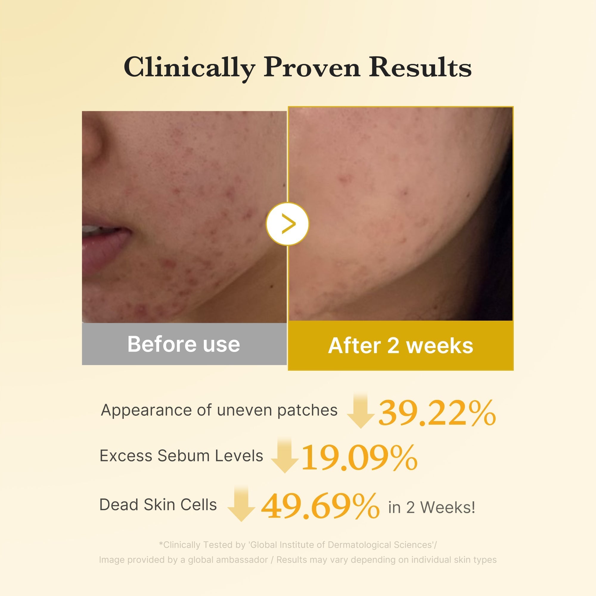 Kojic Acid Tumeric Toner Pad - Modern Skincare