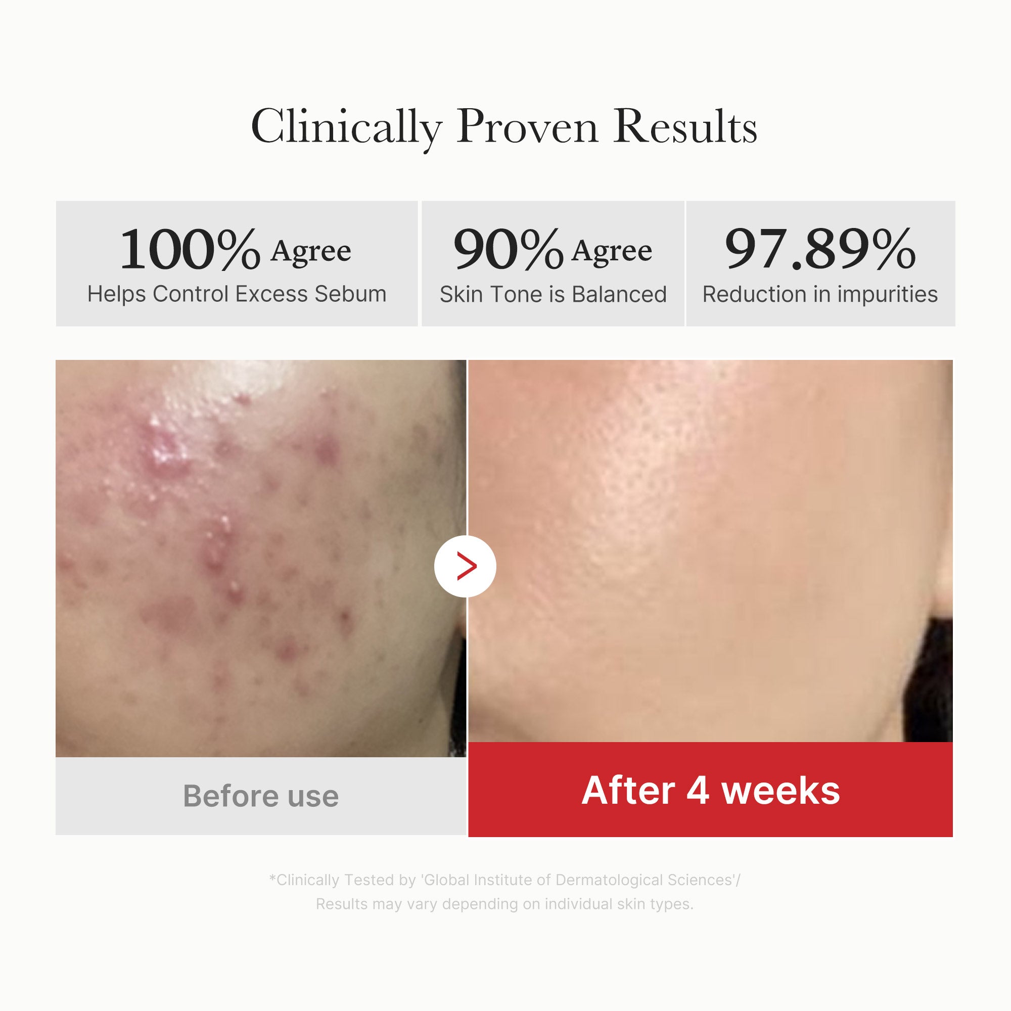 Red Succinic Acid Panthenol Pads - Glow Care Made Easy