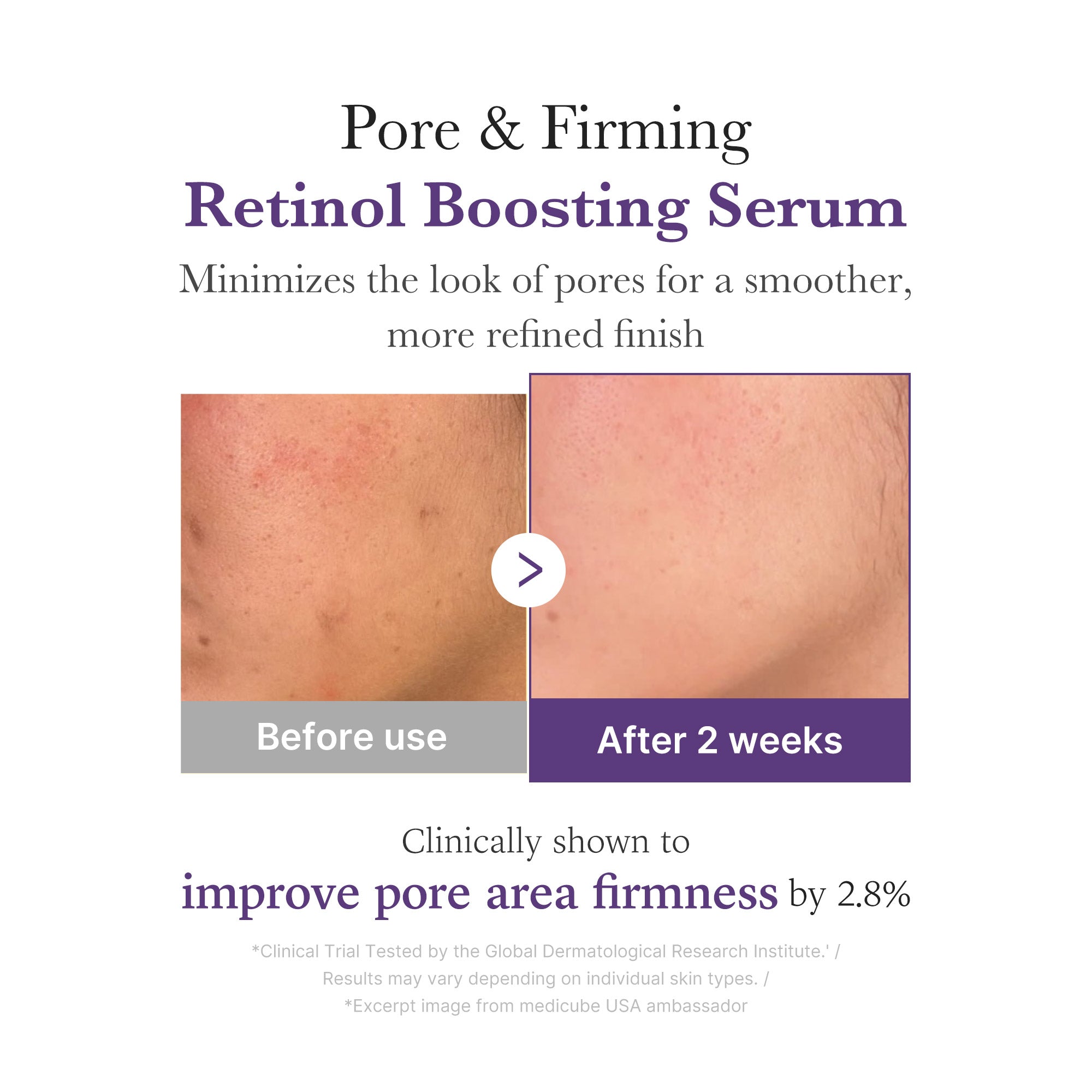 Retinol NMN Boosting Serum - Hydration Favorites