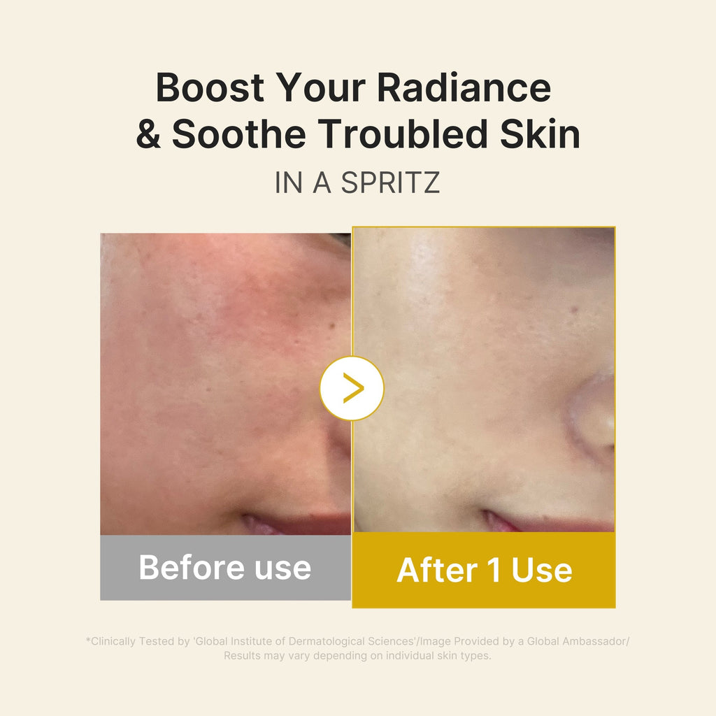 Kojic Acid Turmeric Vitamin Gold Jelly Mist Serum - Daily Glow Care