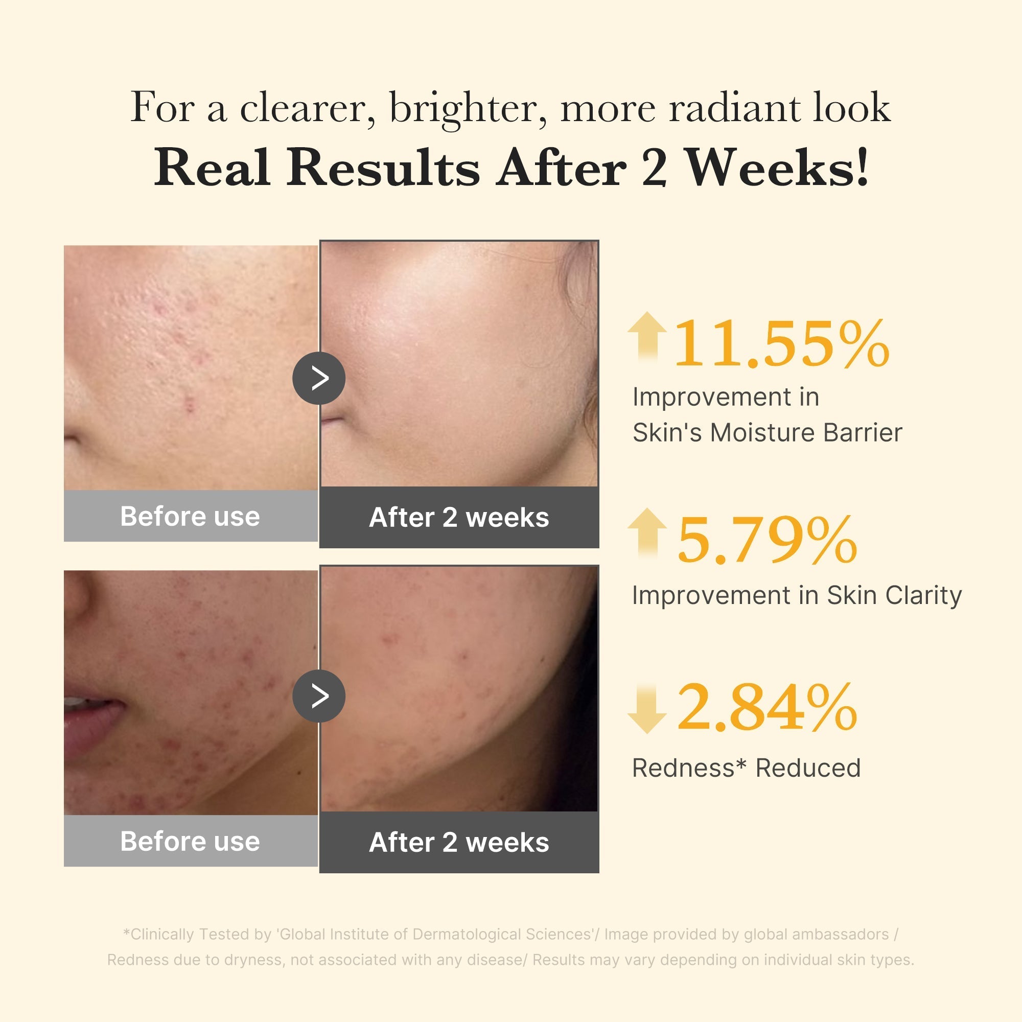 Kojic Acid Turmeric Capsule Serum - Soft Skin Routine