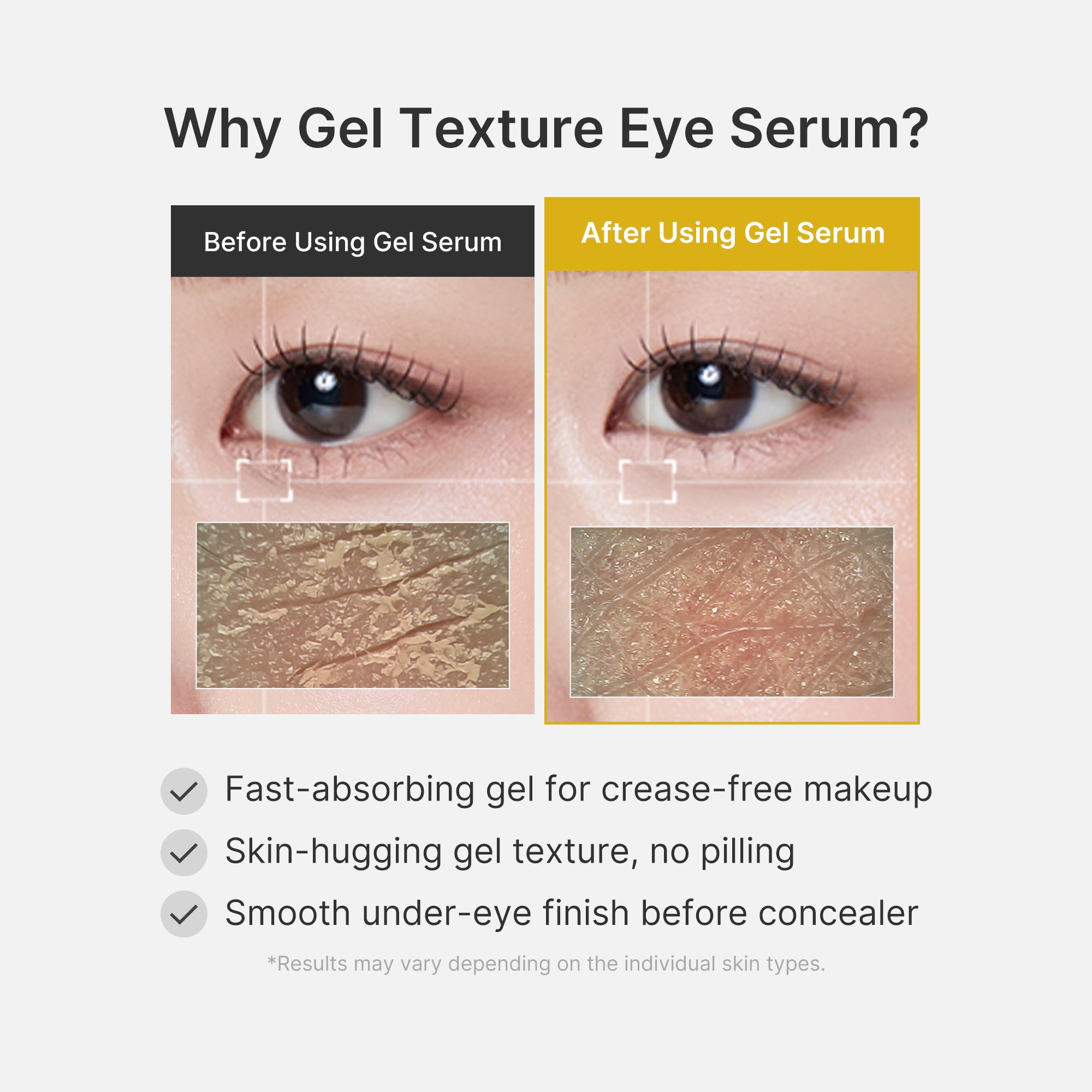 Kojic Acid Tumeric Eye Gel Serum - Your Glow Care