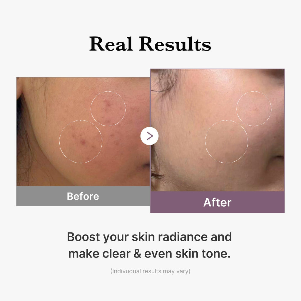 AGE-R Glutathione Glow Milk Toner - Skincare Favorites
