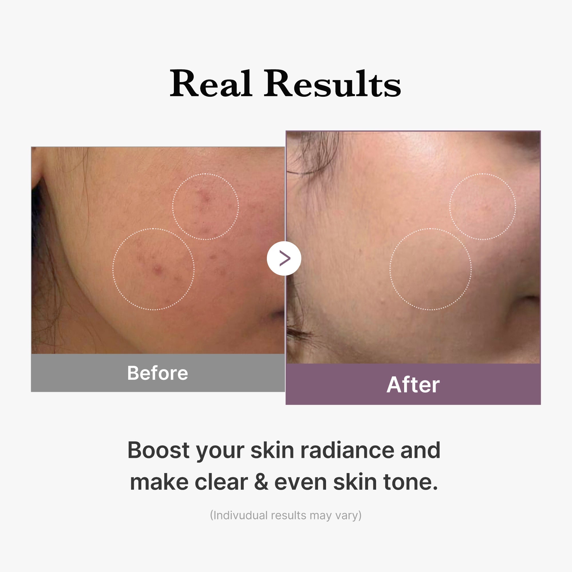 AGE-R Glutathione Glow Milk Toner - Skincare Favorites