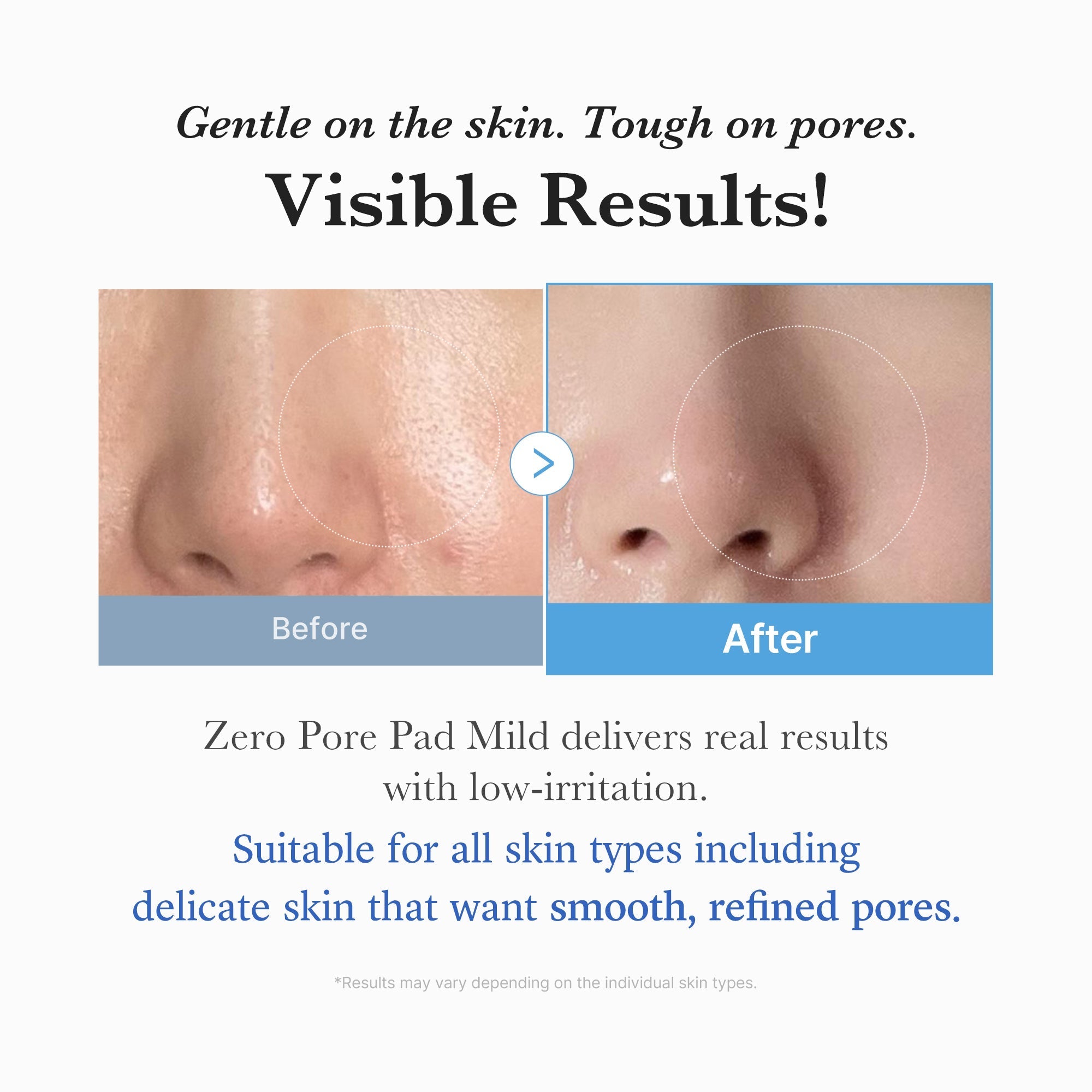 Zero Pore Madecassoside Pads (Mild) - Routine Made Easy