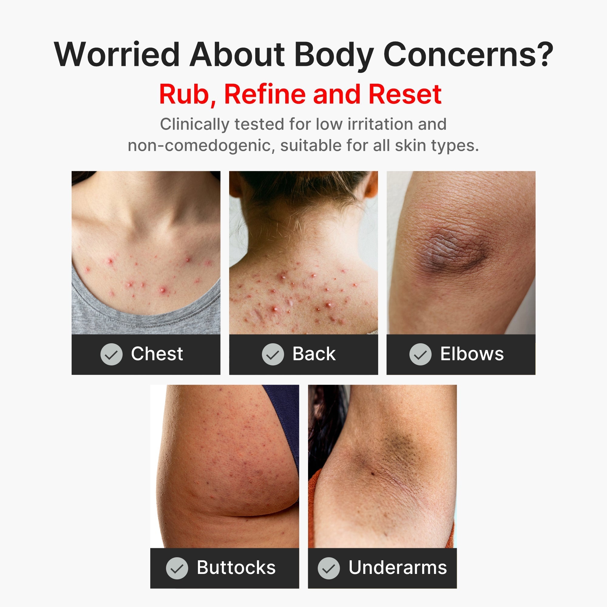 Kojic Acid Turmeric Body Peel Shot - Glow Care Made Easy