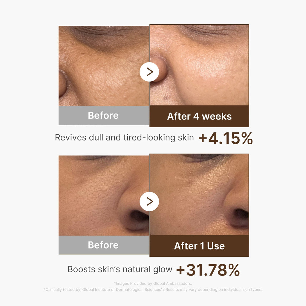 Deep Vitamin C Capsule Serum - Simple Skin Routine