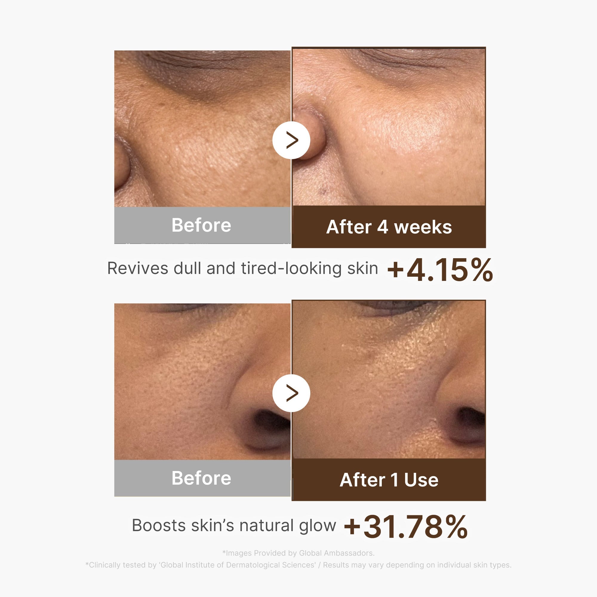 Deep Vitamin C Capsule Serum - Simple Skin Routine