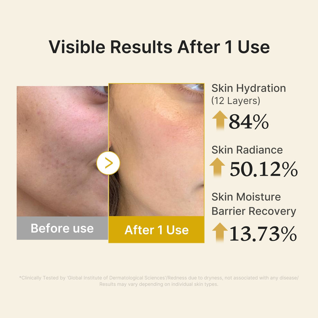 Kojic Acid Turmeric Vitamin Gold Jelly Mist Serum - Daily Glow Care