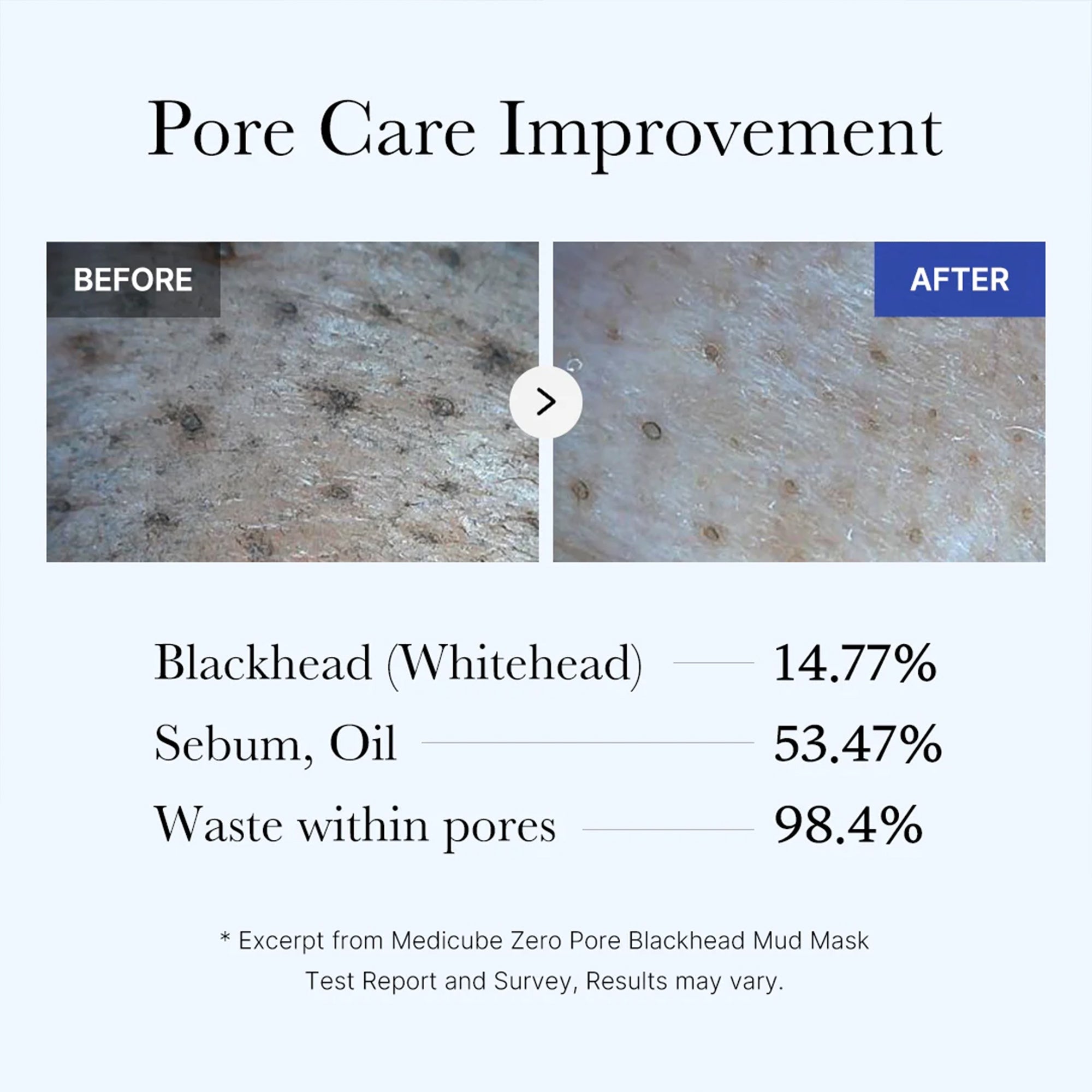 Zero Pore Blackhead Mud Mask - Your Glow Routine