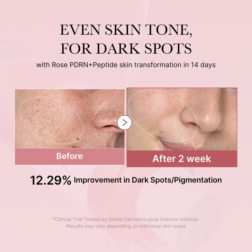 PDRN Pink Peptide Toner - Soft Skin Routine