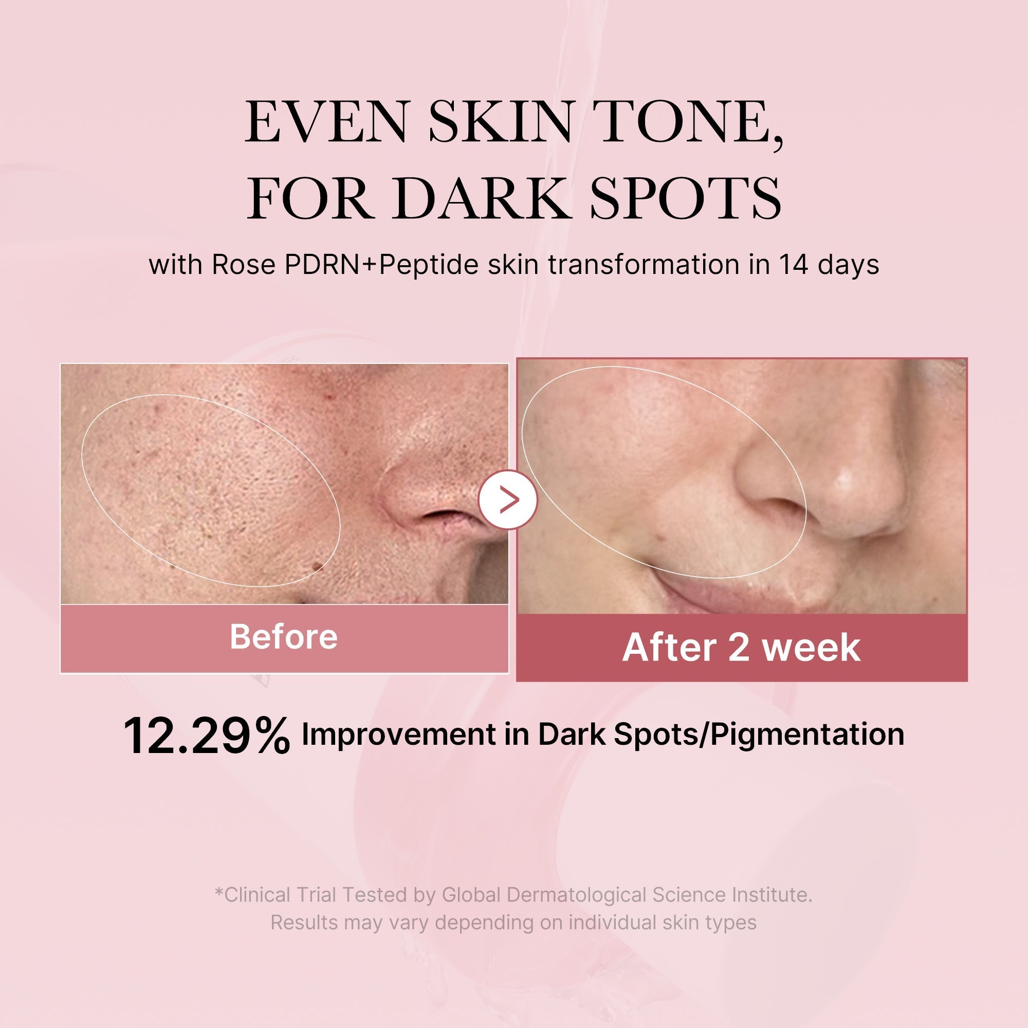 PDRN Pink Peptide Toner - Soft Skin Routine