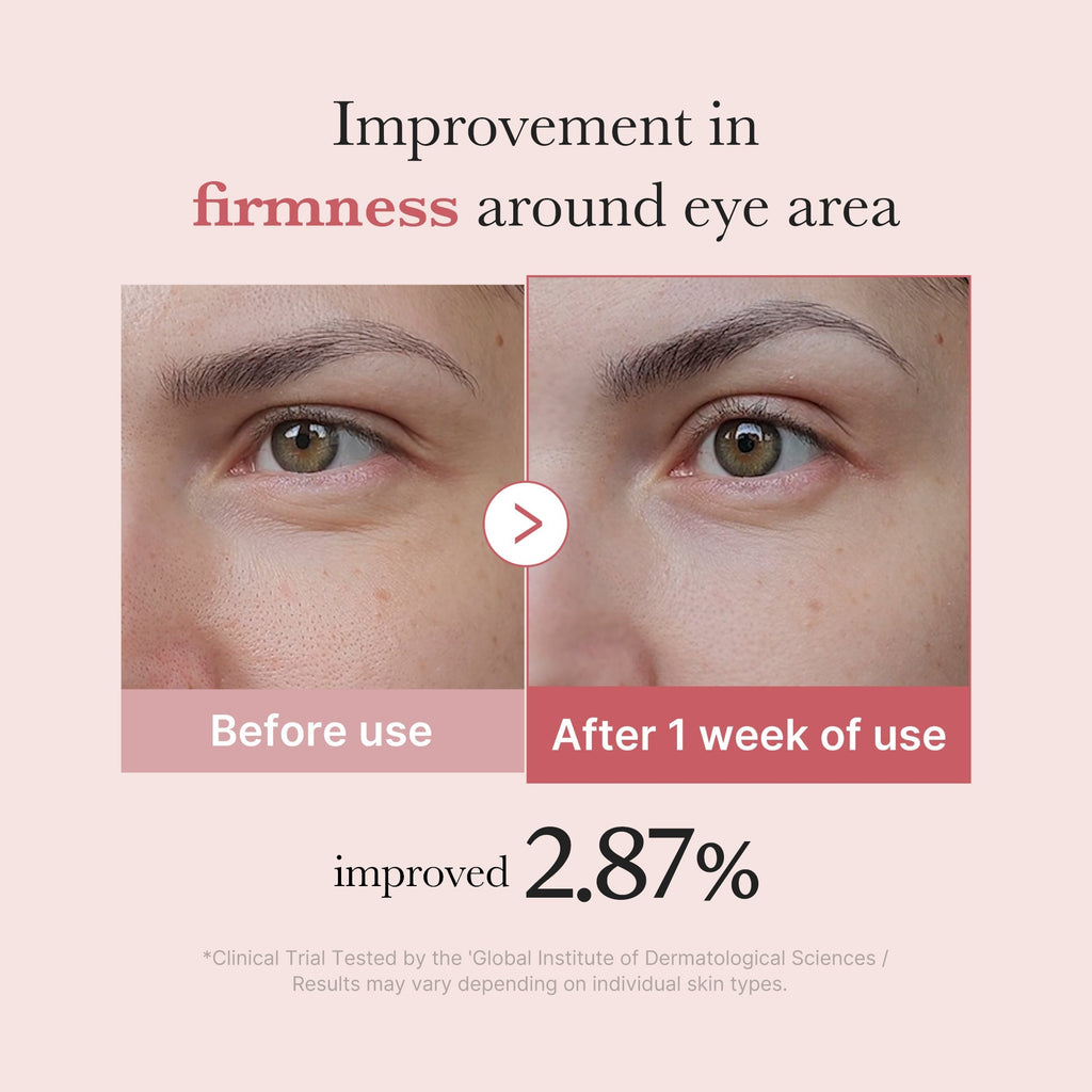 PDRN Pink Peptide Eye Cream - Glow Every Day