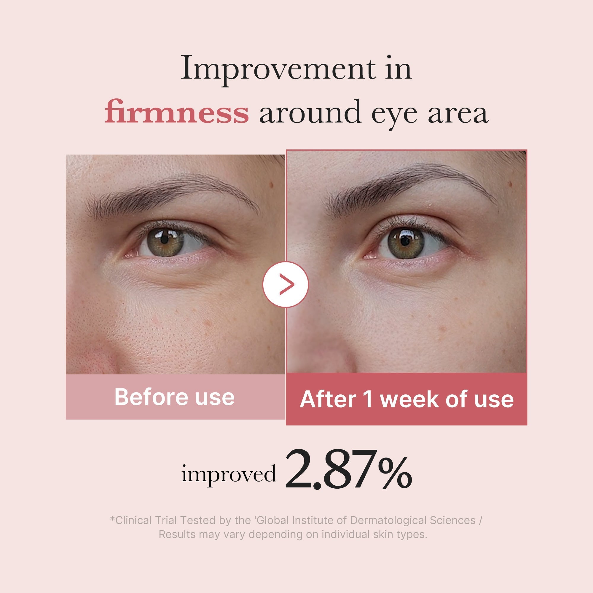 PDRN Pink Peptide Eye Cream - Glow Every Day