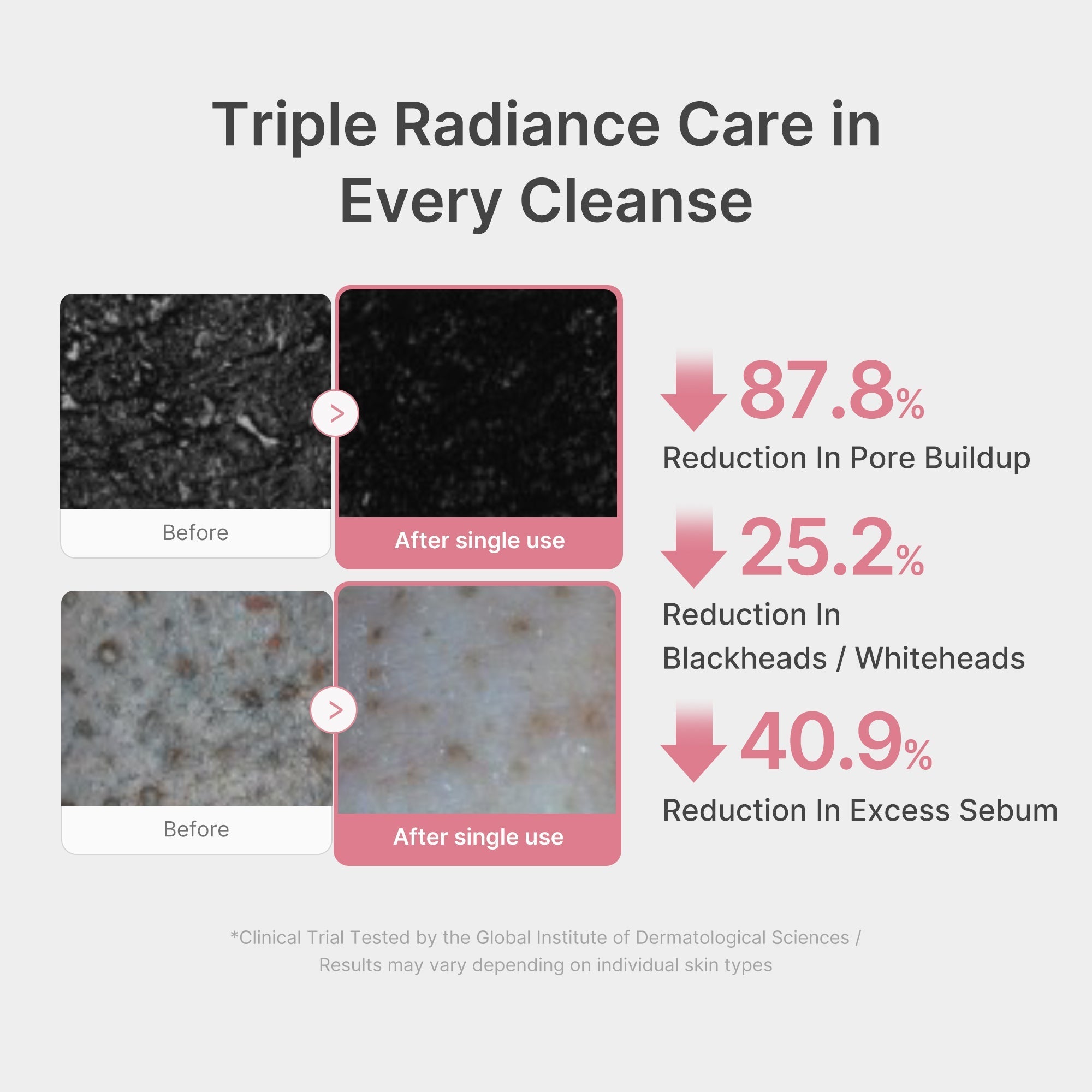 PDRN Pink Glutathione Capsule Foam Cleanser - Skin Refresh Daily