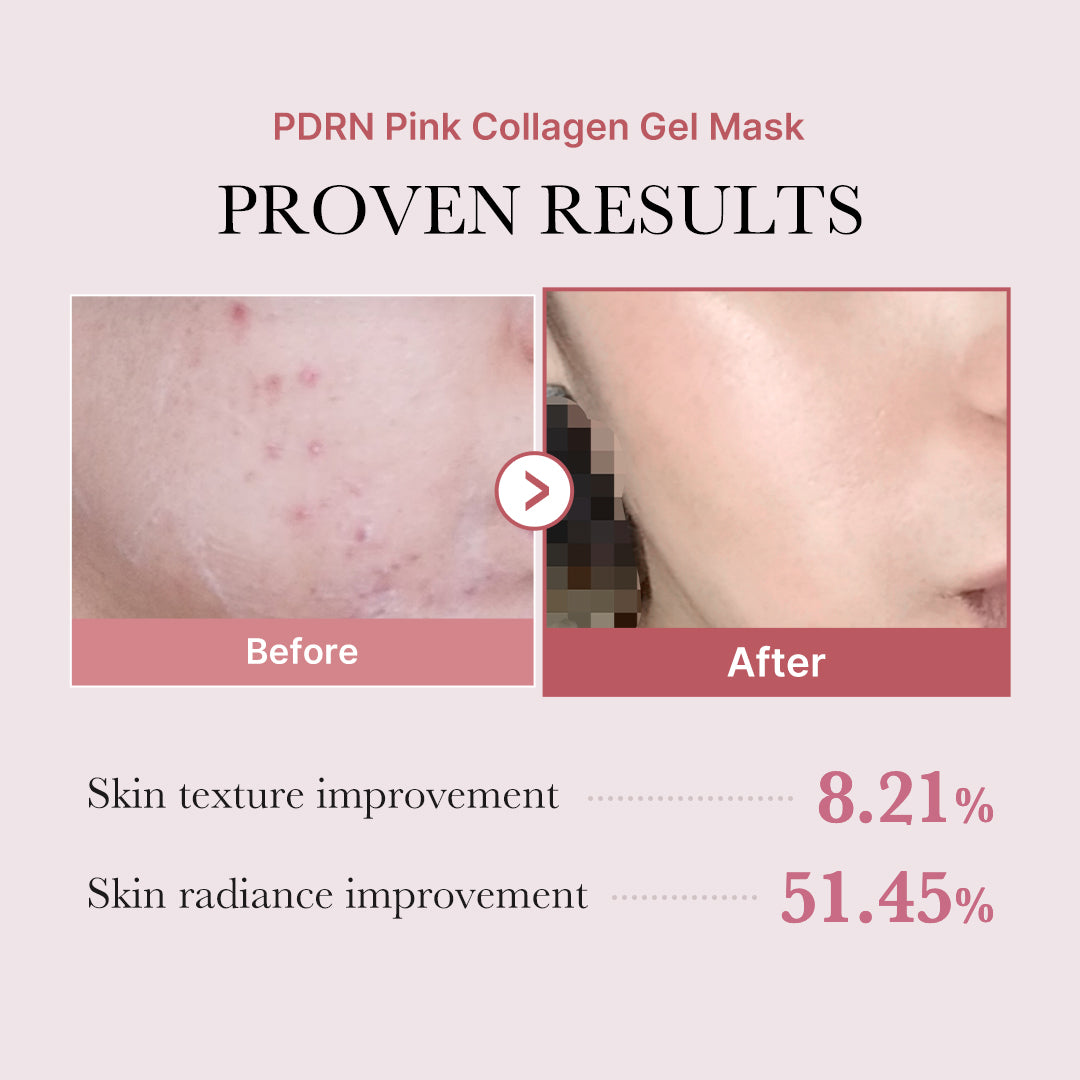 PDRN Pink Glow Full Set - Daily Glow Care