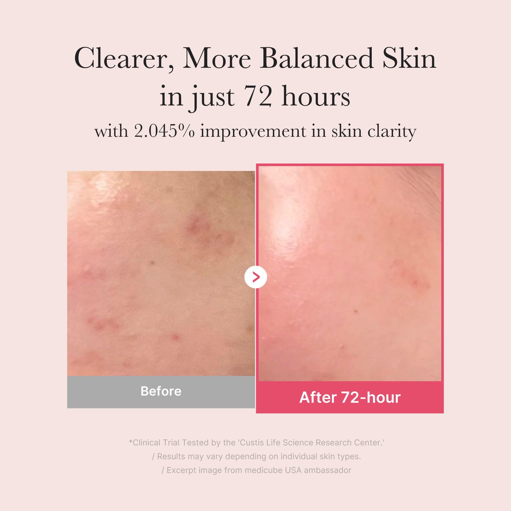 TXA Niacinamide Serum - Skincare Made Simple