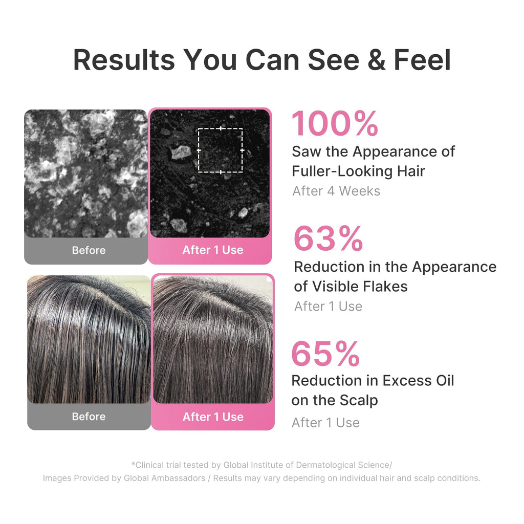 Rosemary PDRN Cooling Thickening Shampoo - Fresh Skin Made Easy
