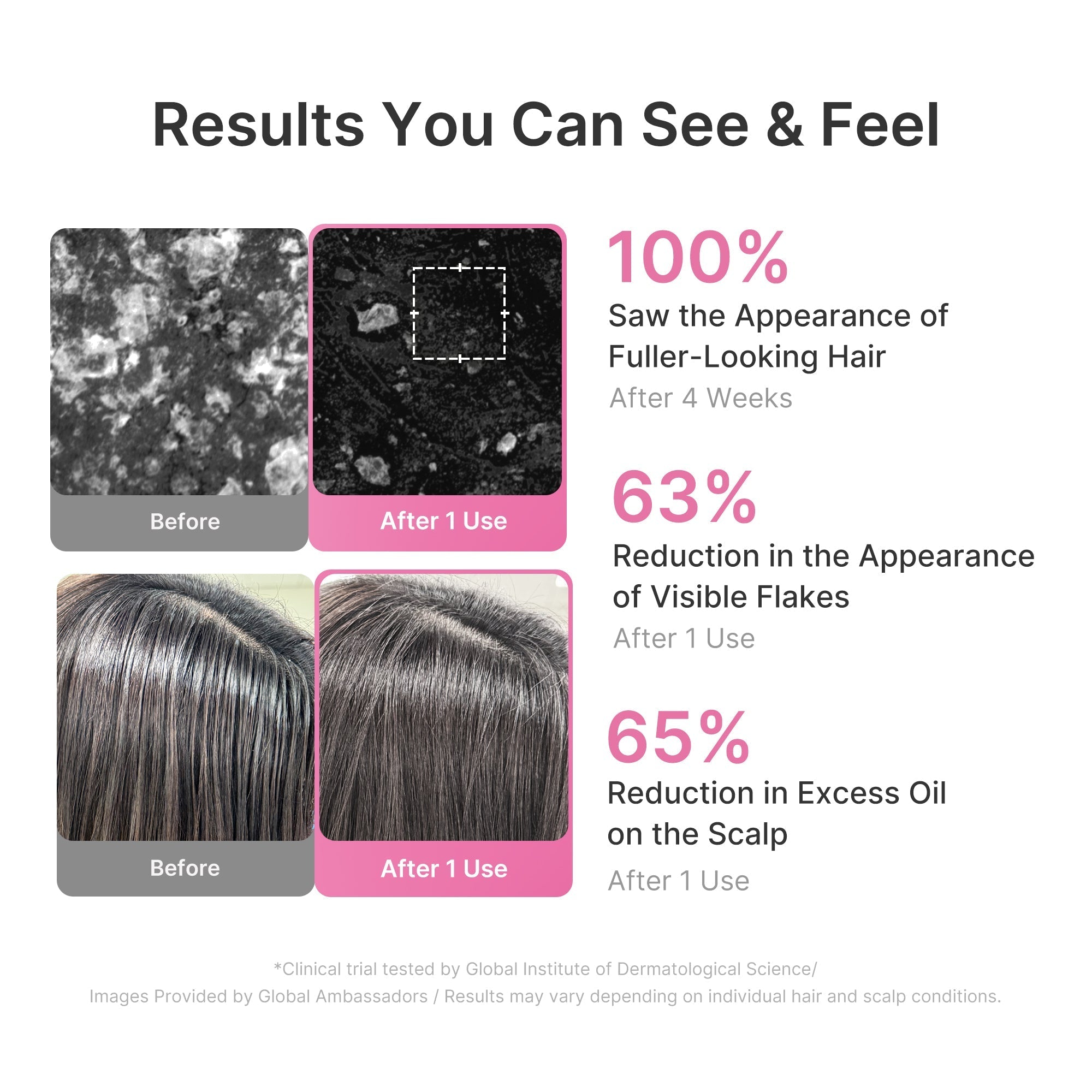 Rosemary PDRN Cooling Thickening Shampoo - Fresh Skin Made Easy