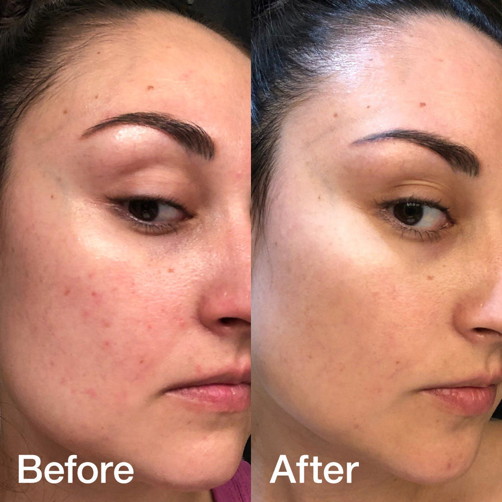 Glass Glow Duo - Ready for Daily Glow