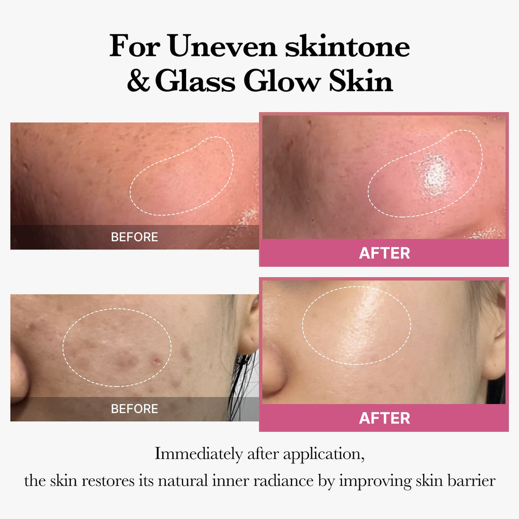[Tati's Exclusive] Plump Perfection Set - Fresh Skin Made Easy